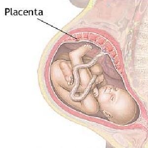 Anomaliile placentei